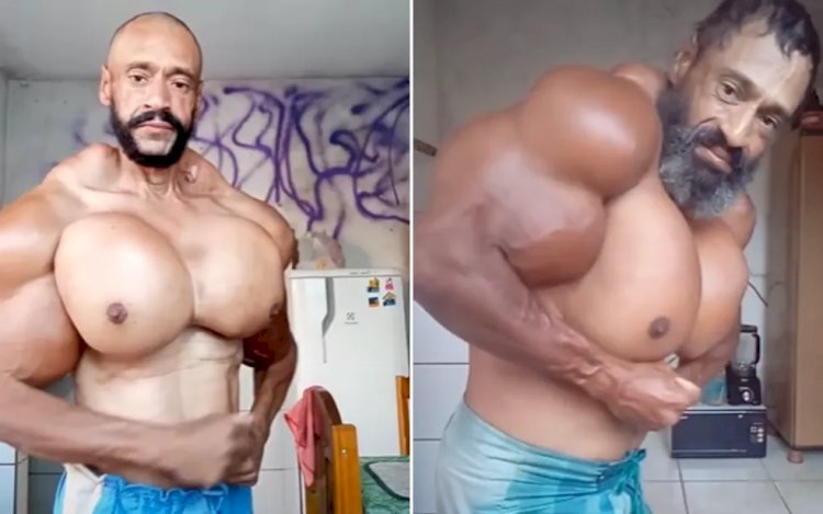 Hulk brasileiro aplicava óleo mineral para ficar com músculos grandes; saiba como substância age no organismo