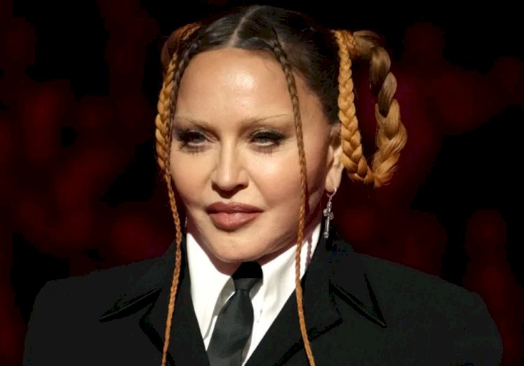 Especialista analisa aparência de Madonna após procedimentos estéticos