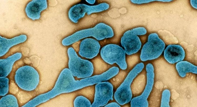 Sobe para 11 total de mortos por vírus Marburg na Guiné Equatorial