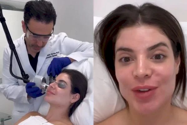 Gkay vai a dermatologista de Kim Kardashian nos EUA. Saiba detalhes