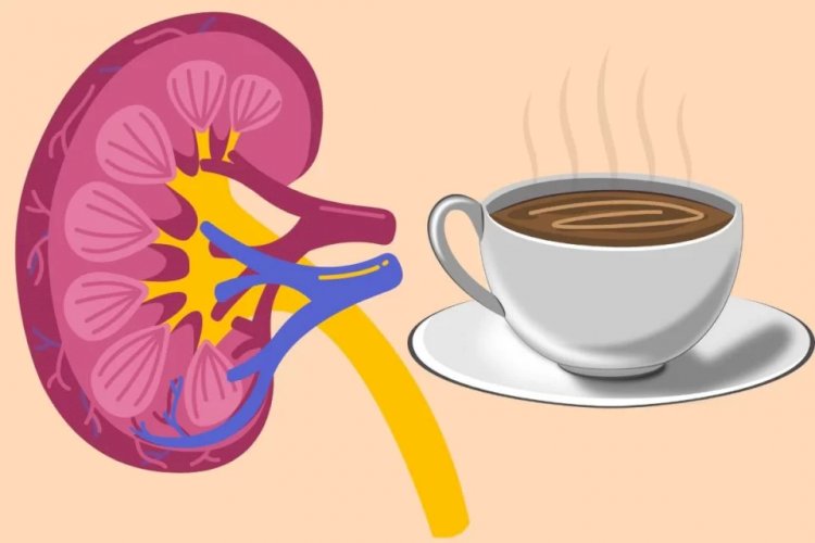Beber café aumenta ou diminui o risco de pedras nos rins? Descubra!