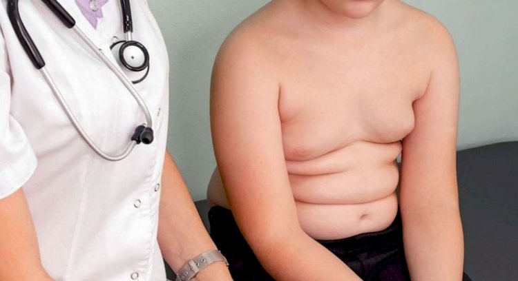 Obesidade entre os jovens: saiba como evitar e tratar