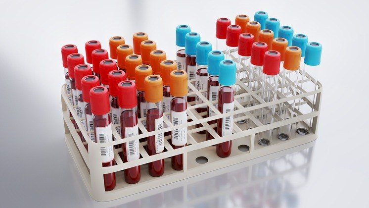 Creatinina, TSH, ALT... O que os exames de sangue mostram sobre as funções do organismo?