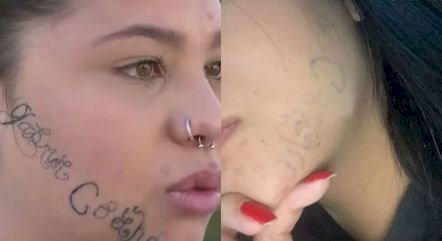 Jovem tatuada no rosto à força pelo ex diz que evitava se olhar no espelho, mas hoje vive nova fase